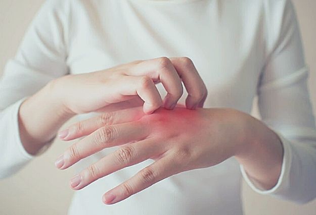Causes of Itchy Hands and Feet
