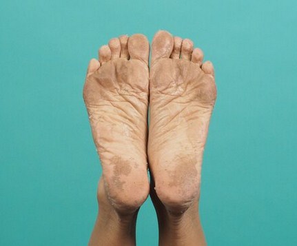 Remove Cracks In Your Feet